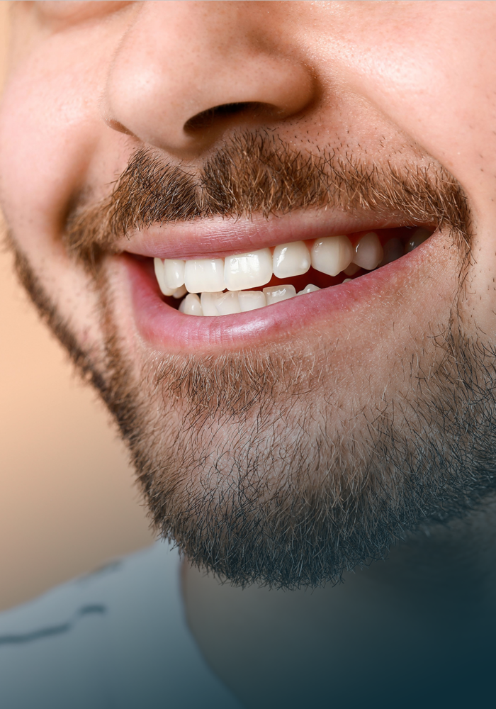 Root Canal Treatment