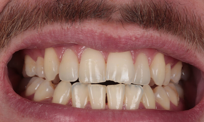 Before - Lakewood Dental