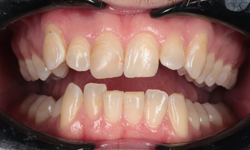 Before - Lakewood Dental