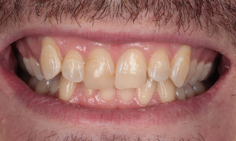 Before - Lakewood Dental