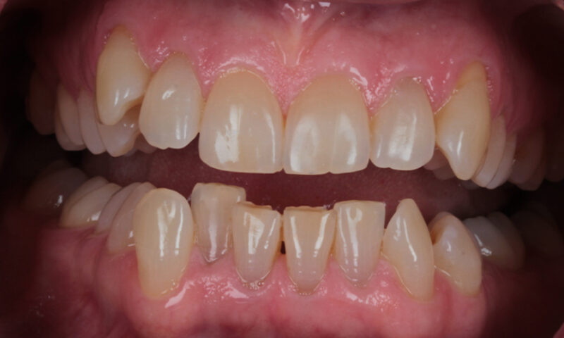 Before - Lakewood Dental