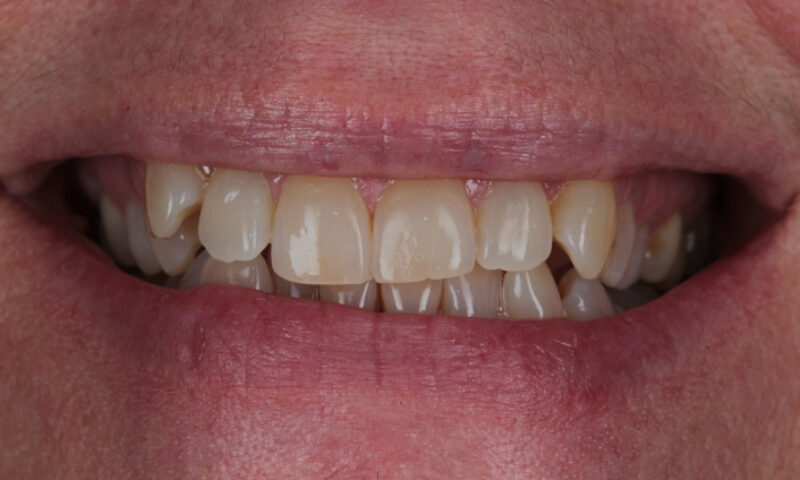 Before - Lakewood Dental