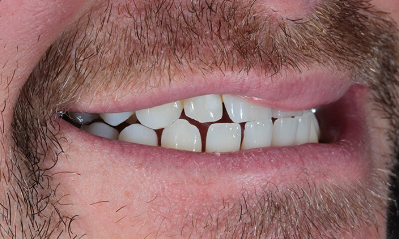 Before - Lakewood Dental