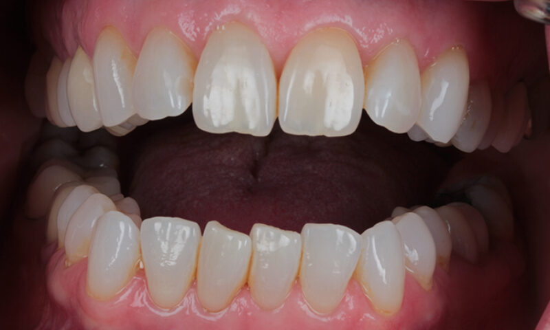 Before - Lakewood Dental