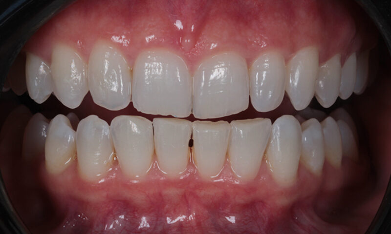 Before - Lakewood Dental