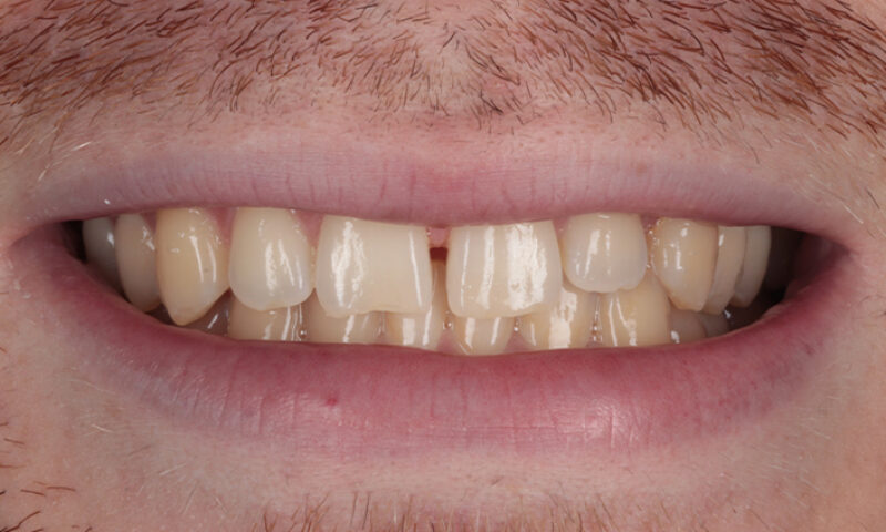 Before - Lakewood Dental