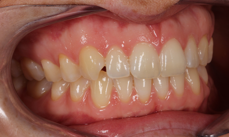 Before - Lakewood Dental