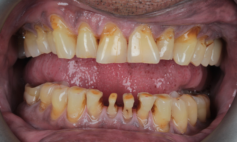 Before - Lakewood Dental