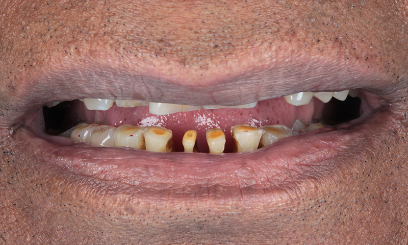 Before - Lakewood Dental