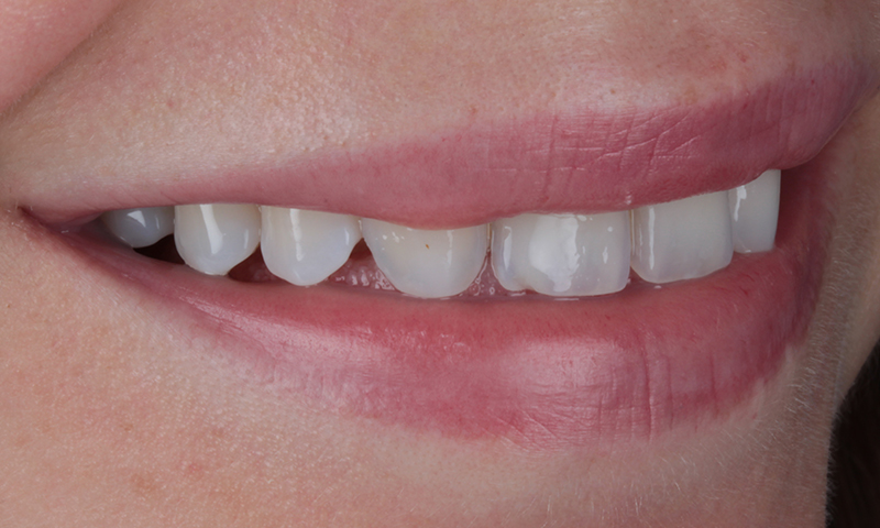 Before - Lakewood Dental