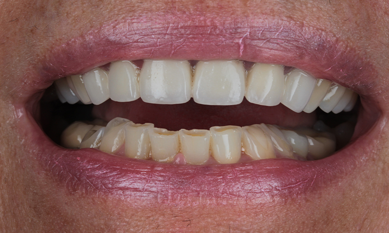 Before - Lakewood Dental