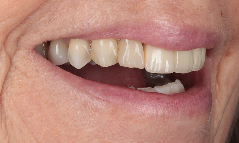 Before - Lakewood Dental