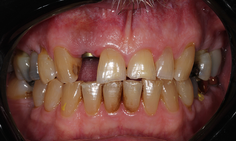 Before - Lakewood Dental