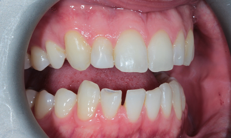 Before - Lakewood Dental
