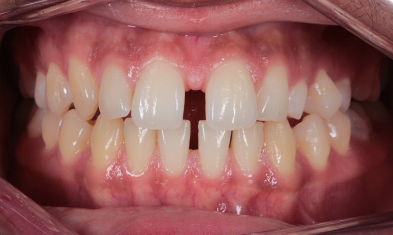 Before - Lakewood Dental
