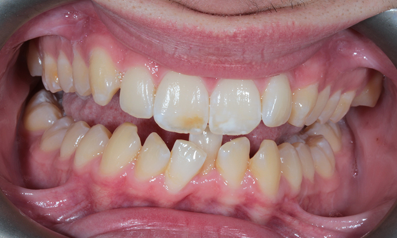 Before - Lakewood Dental