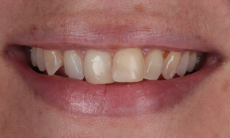Before - Lakewood Dental