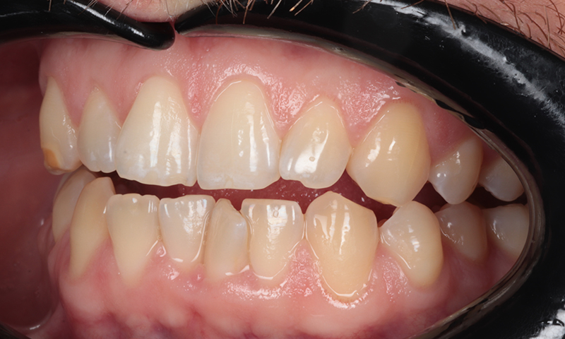 Before - Lakewood Dental