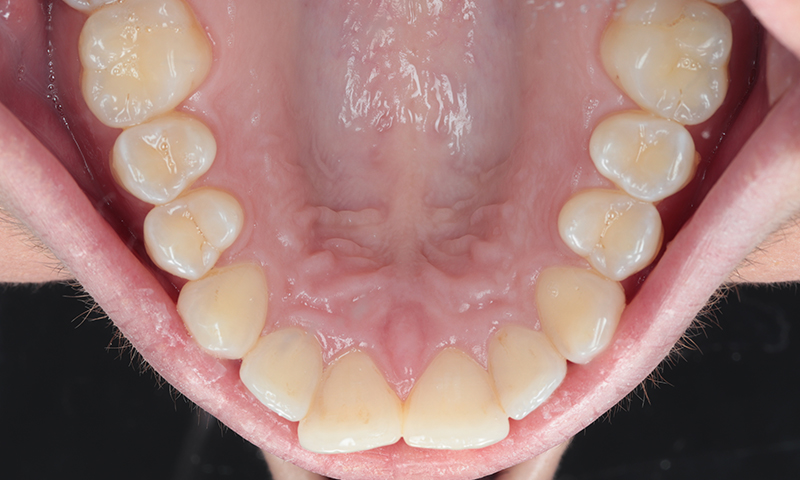 Before - Lakewood Dental