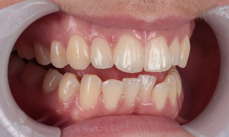 Before - Lakewood Dental