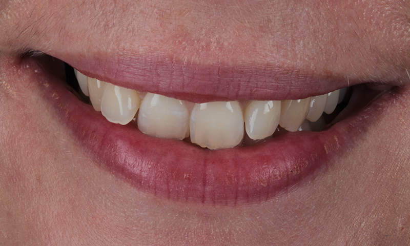 Before - Lakewood Dental