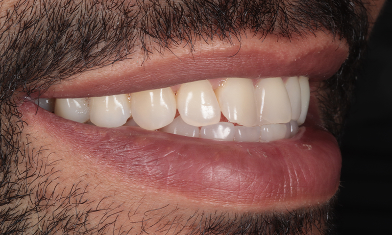 Before - Lakewood Dental