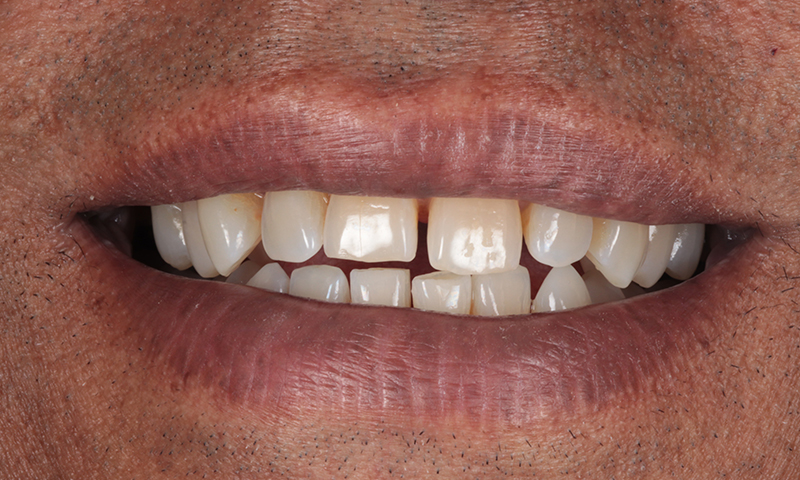 Before - Lakewood Dental