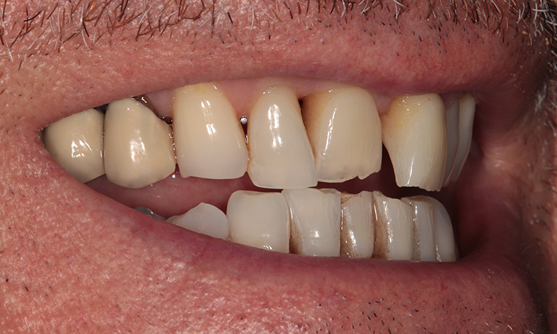 Before - Lakewood Dental