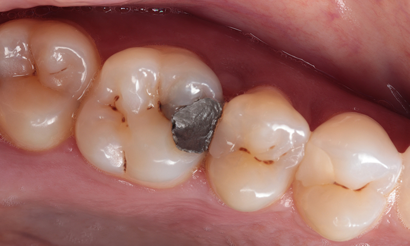 Before - Lakewood Dental