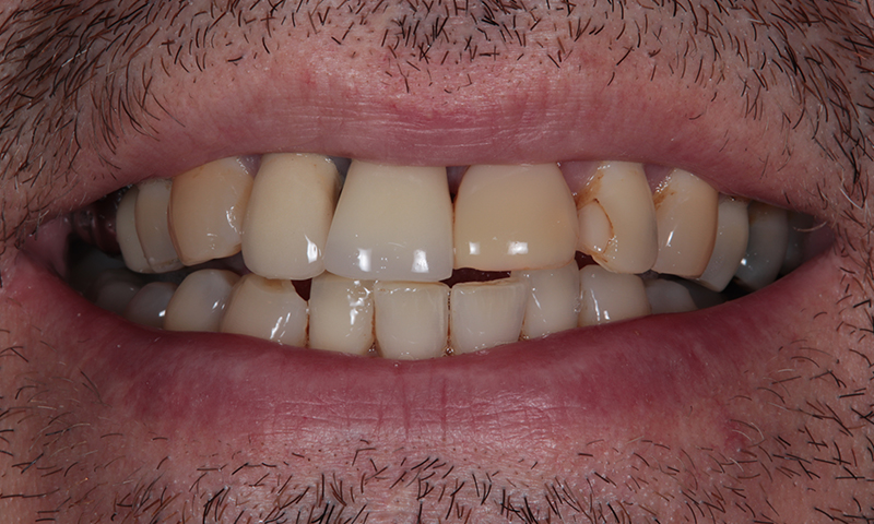 Before - Lakewood Dental