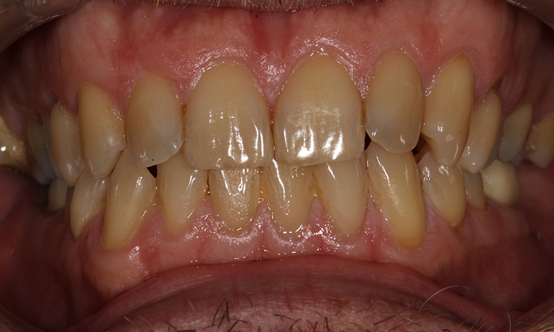 Before - Lakewood Dental